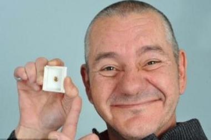 Ausies skausmo priežastis – 33 metus įstrigęs dantis