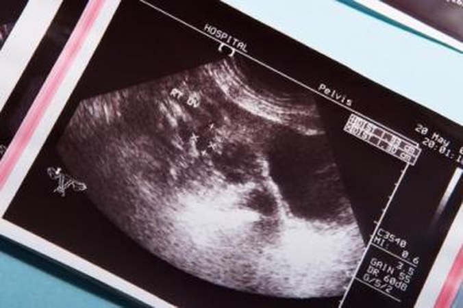 Tyrimas: medikams reikia žinių ir patirties pažinti, ką fiksuoja ultragarso bangos.