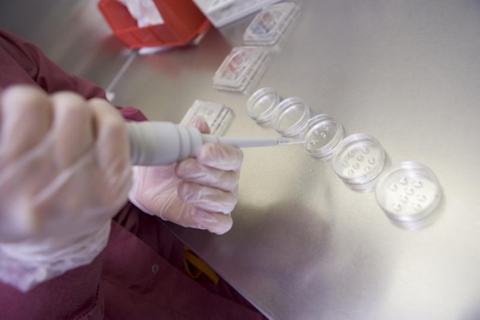 Pro mikroskopą: spermatozoidai į kairę nesuka 